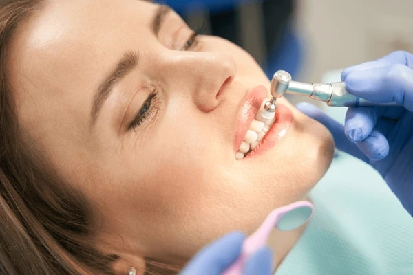 dental cleanings in mission calgary