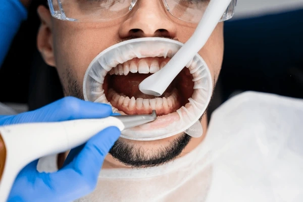 dental cleanings near you