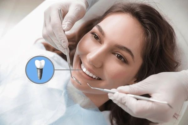 dental implants in mission calgary