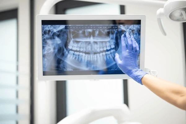 digital x rays in mission calgary