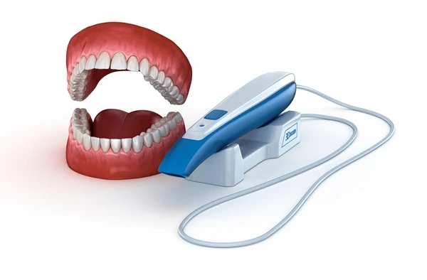 itero wellness intraoral scans near you