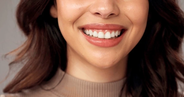 teeth whitening in mission calgary